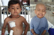 A fathers heartfelt appeal: Help me save my 2.5 year old from blood cancer